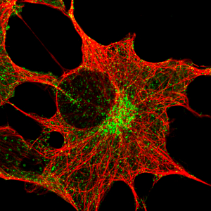Antibody Labeling Kit